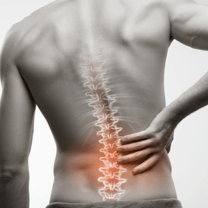 Acupuncture a for Lower Back Pain